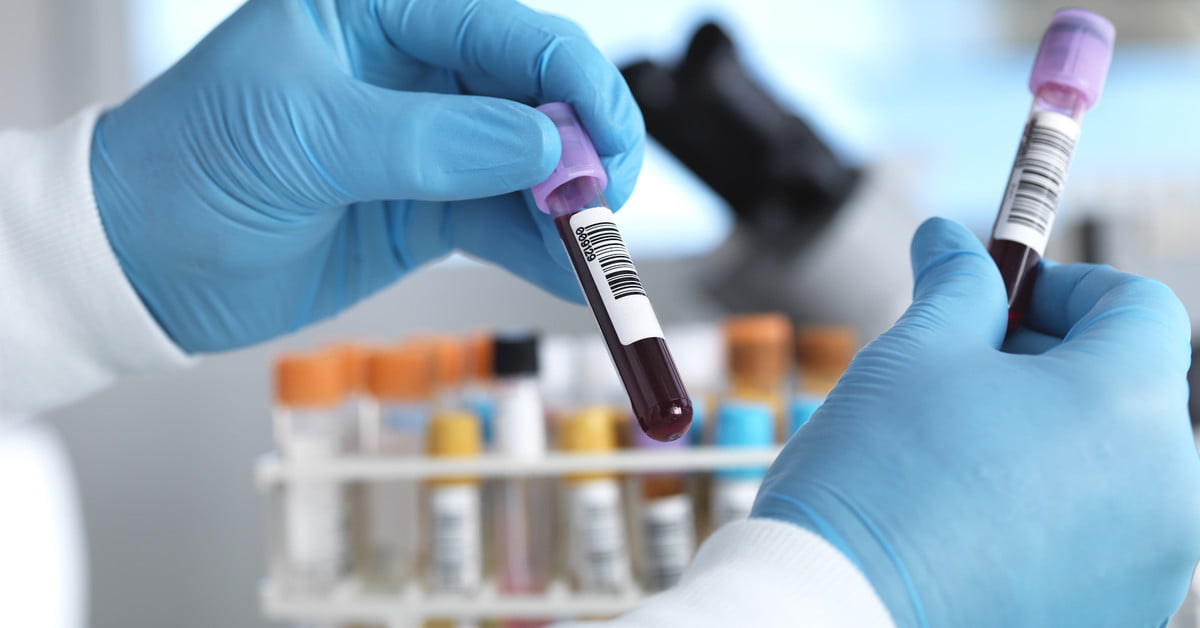 scientist holding test tube blood sample